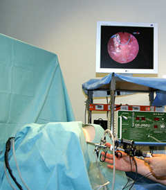 Гистероскопия матки