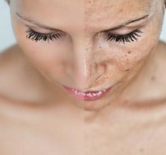 Как отбелить лицо от загара без ущерба для здоровья