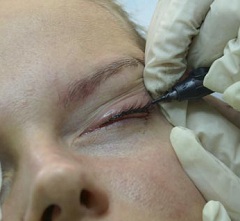 Процедура нанесения татуажа глаз