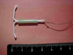 Спираль Мирена - средство контрацепции