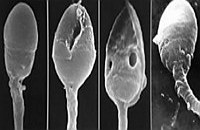 Более точный результат можно получить при расшифровке спермограммы Более точный результат можно получить при расшифровке спермограммы