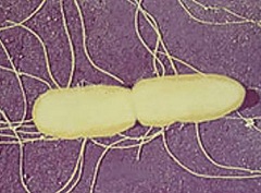 Брюшнотифозная палочка - возбудитель брюшного тифа