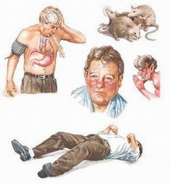 Делирий алкогольный более известен как белая горячка