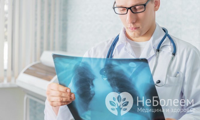 Туберкулез