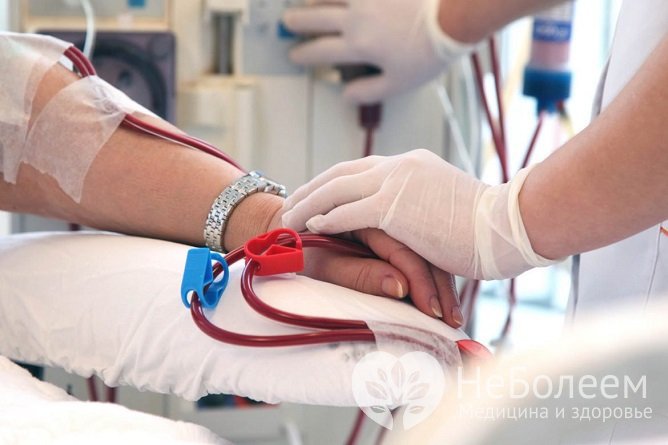 Гемодиализ применяется при лечении ренальной анурии вследствие почечной недостаточности