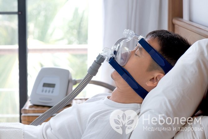 СИПАП-терапия применяется для лечение апноэ сна средней и тяжелой степени