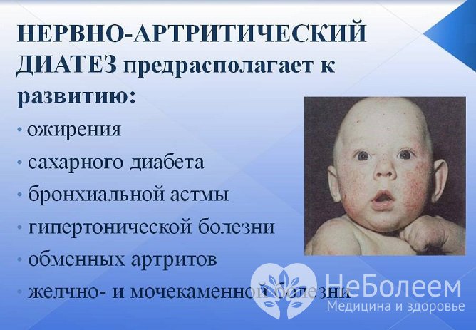 Возможные осложнения диатеза