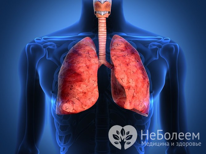 Гистоплазмоз поражает преимущественно легкие, поэтому его часто путают с туберкулезом