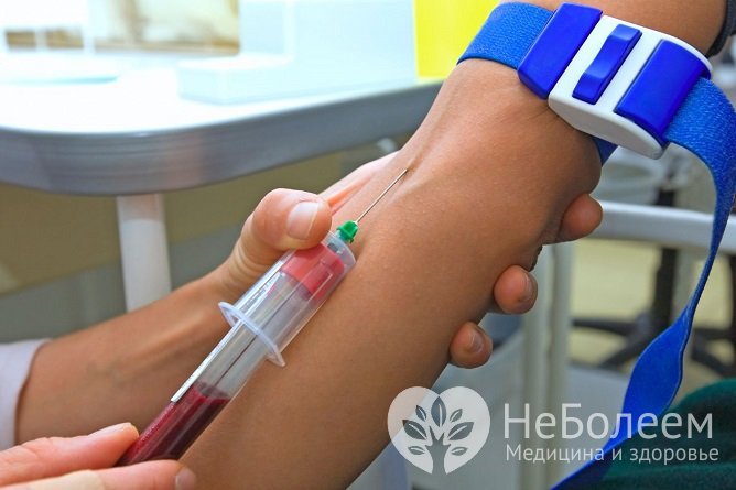 При катаральной ангине анализ крови показывает ускорение СОЭ и повышенное число лейкоцитов