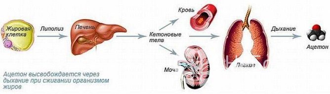 Кетоацидоз – неотложное состояние, связанное с накоплением в крови кетоновых тел