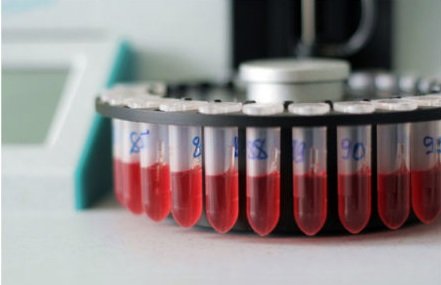 Лимфоцитоз является диагностическим признаком большинства инфекционных заболеваний