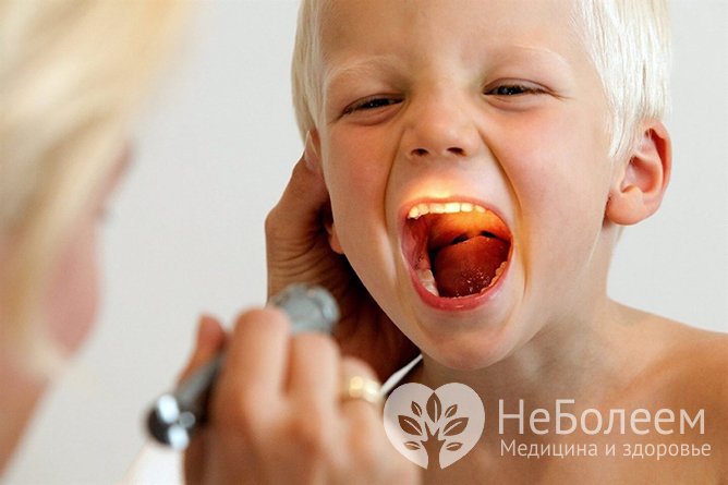 Дифференциальную диагностику проводит ЛОР-врач