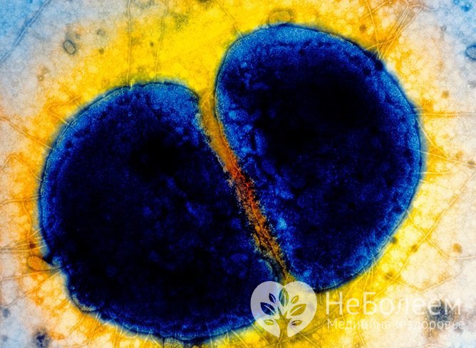 Заражение гонококком – самая распространенная причина уретрита у мужчин