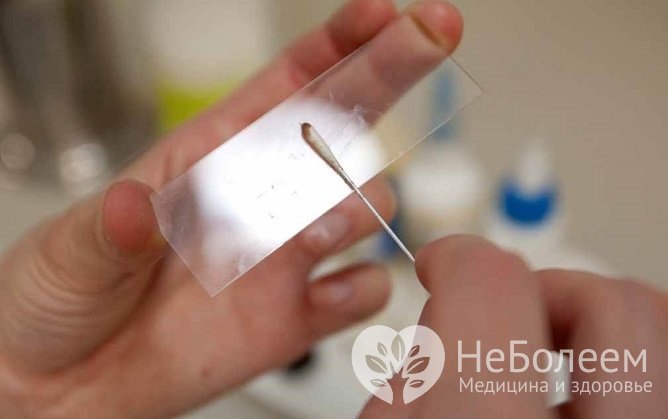 Анализ на энтеробиоз проводится как при подозрении на заболевание, так и с целью профилактики, например, при оформлении в бассейн