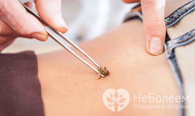 Апитерапия