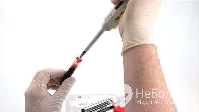 При подозрении на дисбаланс эстрогена необходима лабораторная диагностика