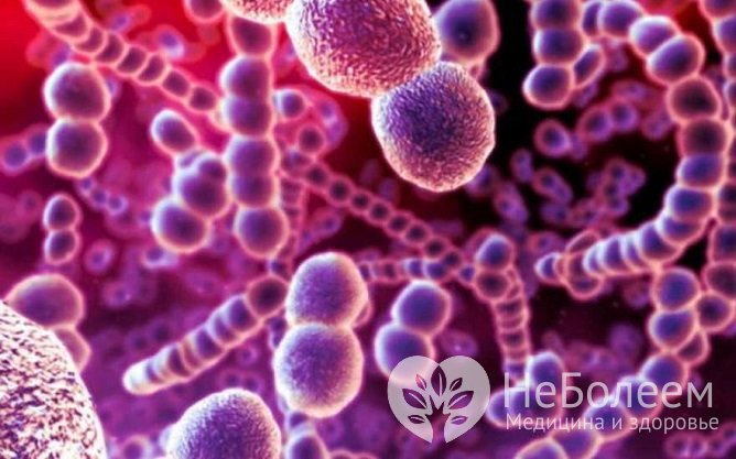 Патогенами фарингита бактериальной этиологии могут быть стрептококки