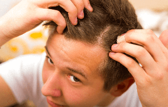 Выпадение волос у подростков